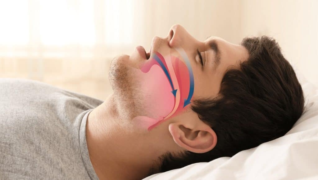5 Best Sleep Apnea Pillows of 2023 Useful For Your Sleeping Positions