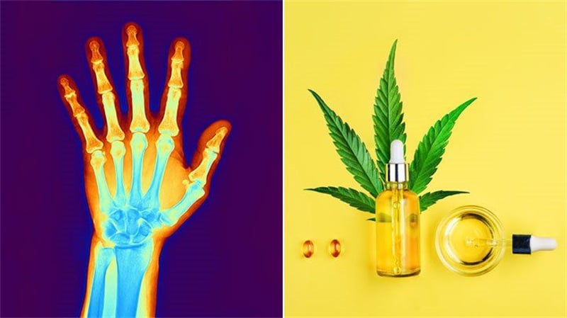 CBD for Joint Pain